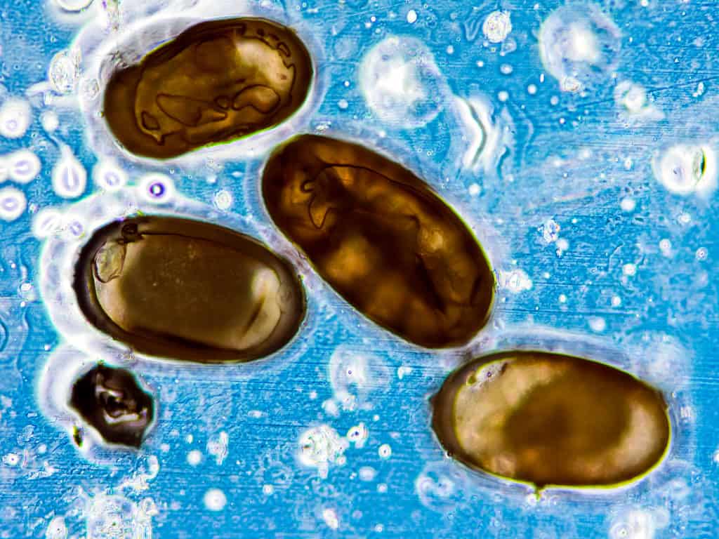 flea eggs magnified