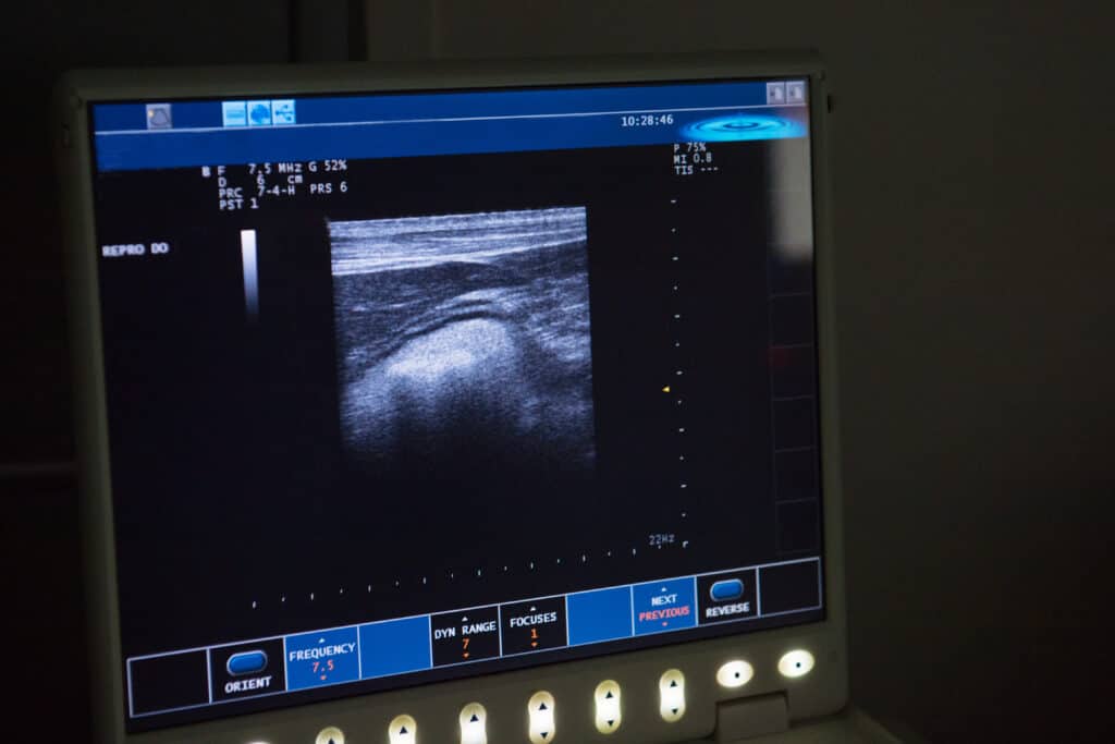 dog stomach ultrasound