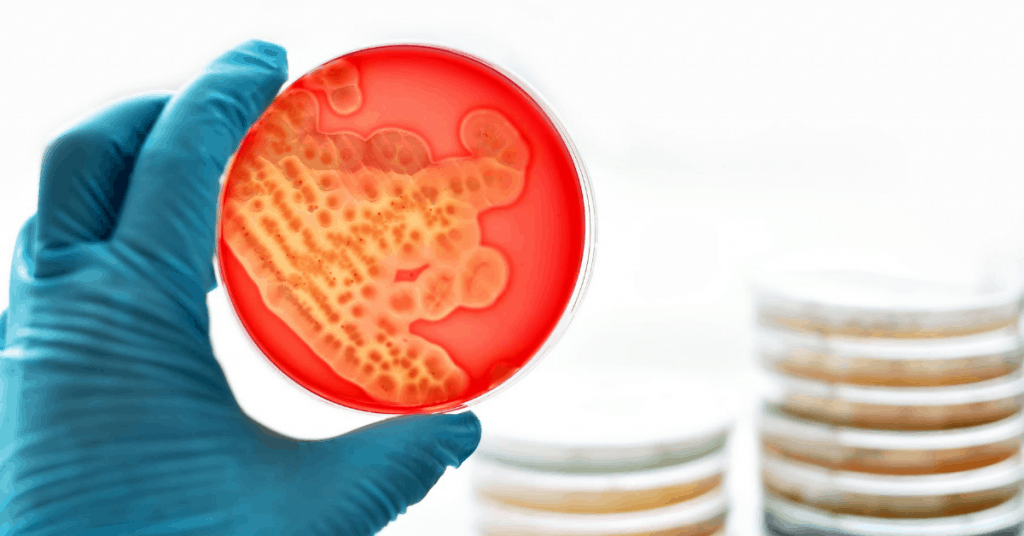 petri dish