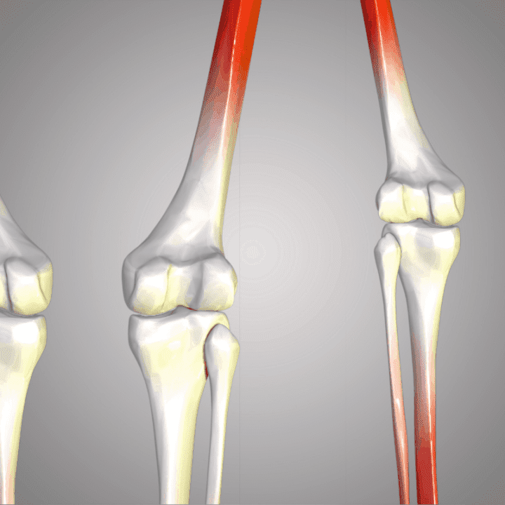 German Shepherd Joint Problems All You Need to Know The German
